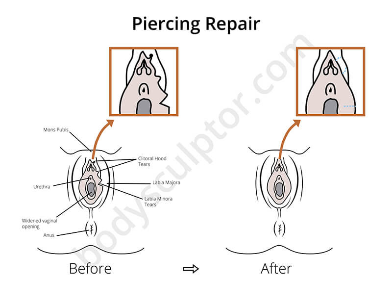 Clit Piercing Healing Process