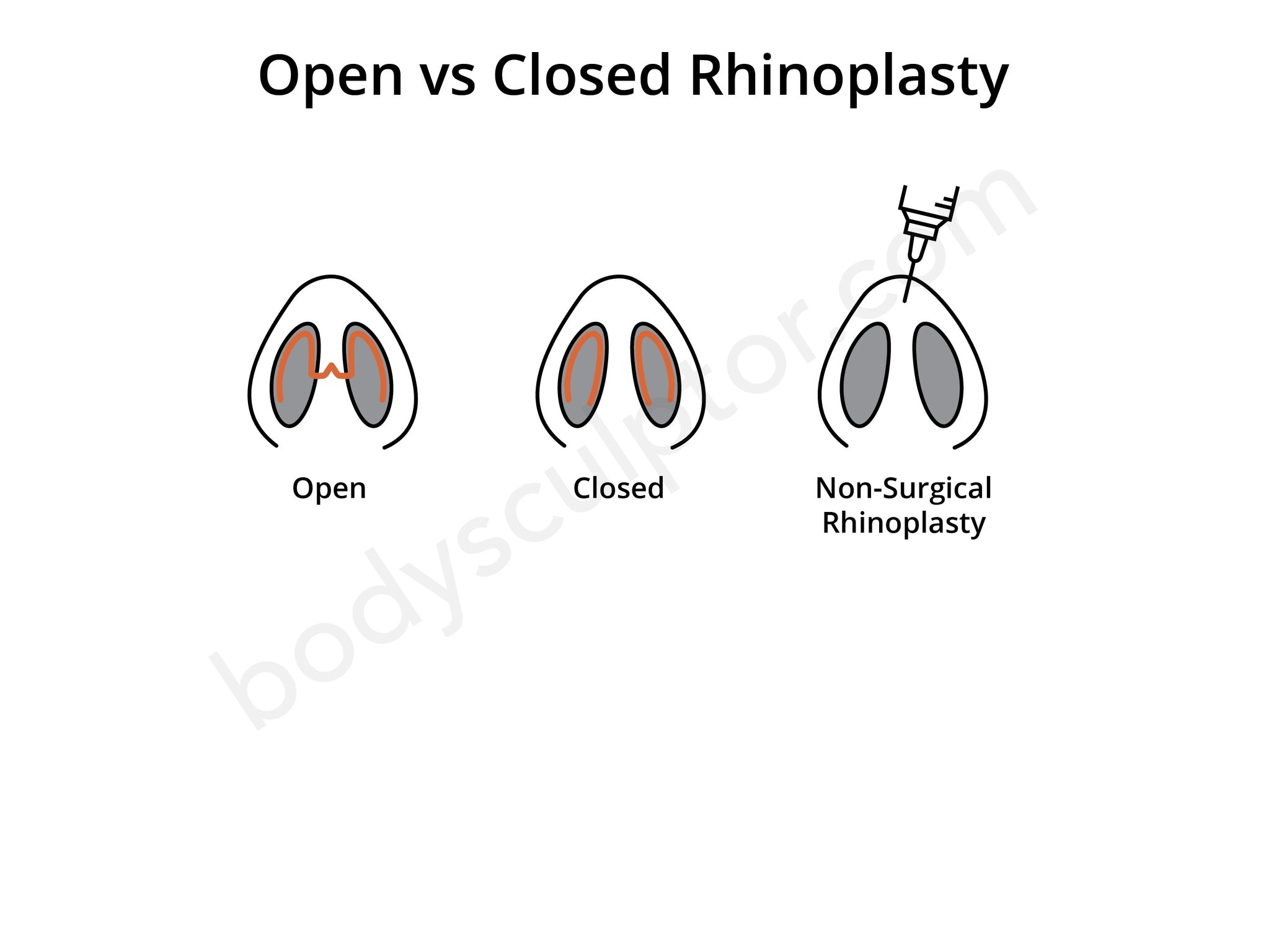 Rhinoplasty Chicago